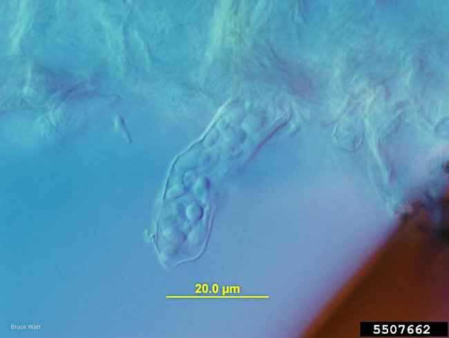 Ασκοί & Ασκοσπόρια του Taphrina deformans