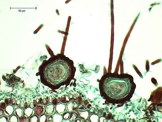 Κλειστοθήκια και Ασκοσπόρια Παραγόμενα από το Ωίδιο της Μηλιάς - © A. Baudoin